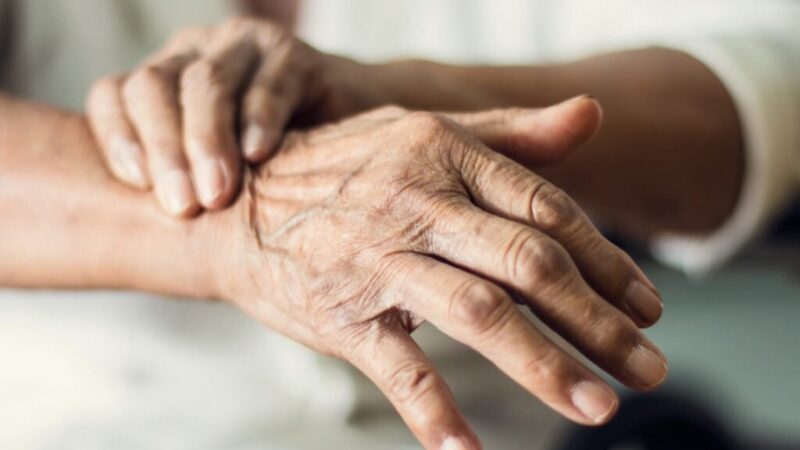 SUS terá primeiro medicamento para demência associada ao Parkinson