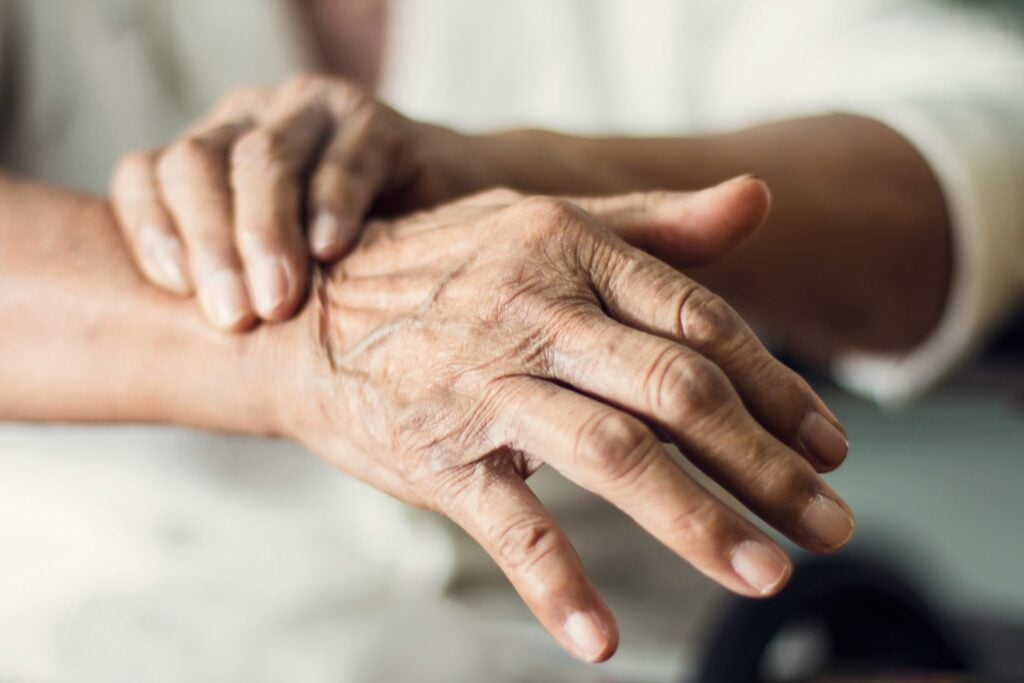 SUS terá primeiro medicamento para demência associada ao Parkinson