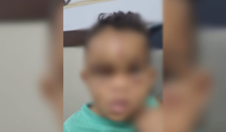 Criança dá entrada em hospital de Sinop com sinais de espancamento