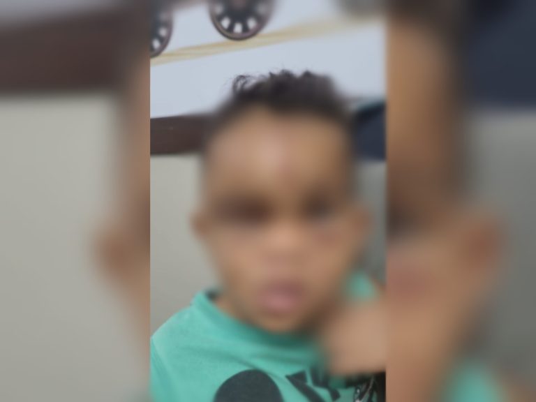 Criança dá entrada em hospital de Sinop com sinais de espancamento