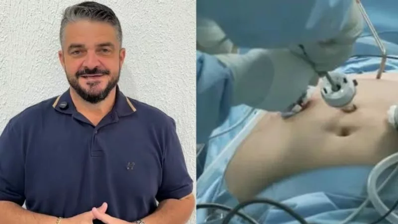 Cirurgia Bariátrica pelo SUS em Sinop: Um Guia Completo